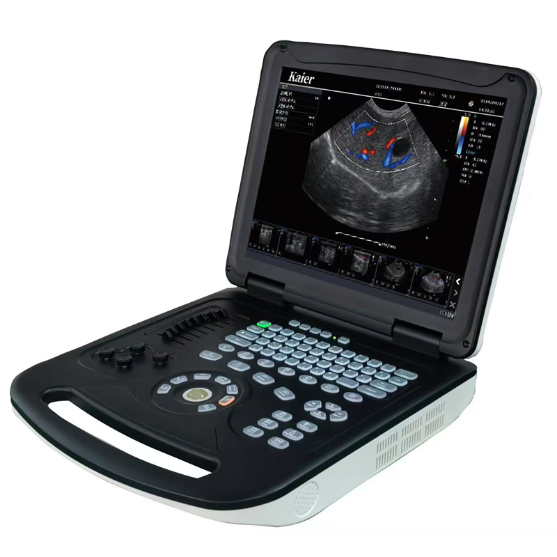 KR-E80筆記本式彩超機(jī)